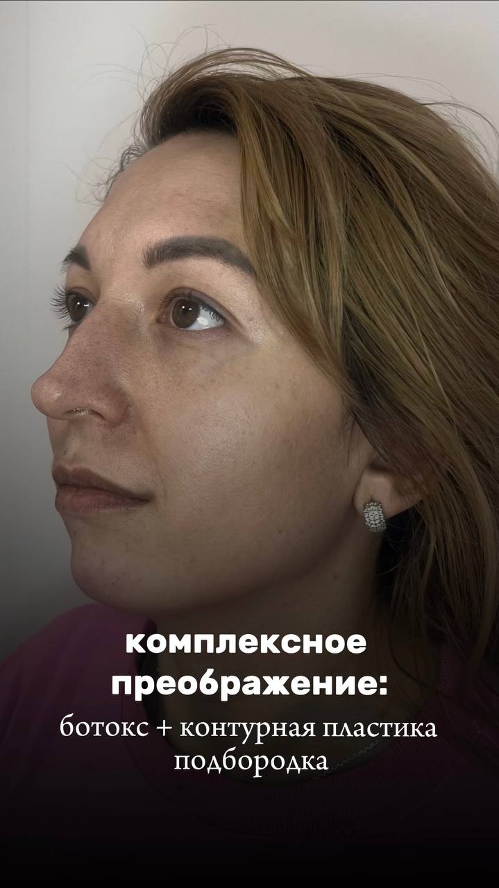 До и после: разница, которую видно сразу ✨